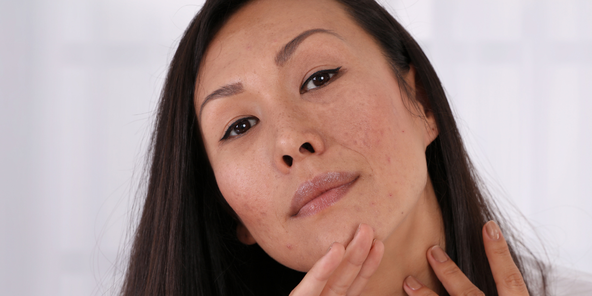 Women with natural skin